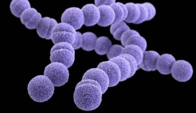 Streptococcus pnemoniae